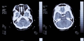 뇌 편도, 생명유지 숨 제어한다