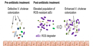 항생제 치료 중 발생하는 장질환 치료 방법 찾아