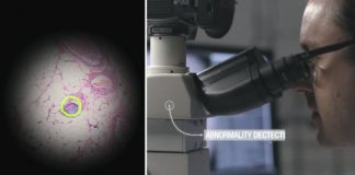 구글, 암 탐지 인공지능 ‘AR 현미경’ 개발