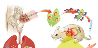 줄기세포-나노약물 결합 폐암 치료