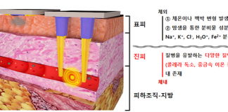 무채혈 ‘바이오 센서’로 질병 진단