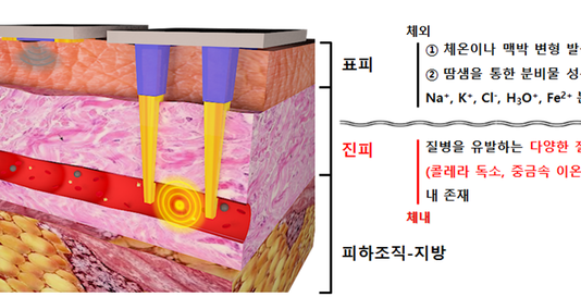 무채혈 ‘바이오 센서’로 질병 진단