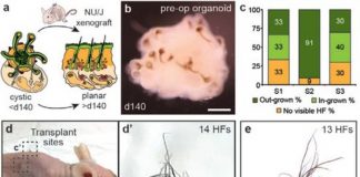 “줄기세포로 만든 피부서 털이 자라나”