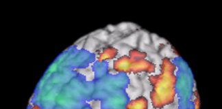 “기존 fMRI 뇌활동 연구 신뢰성 떨어져”