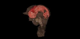 인공자궁으로 토끼 자연임신 성공