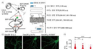 조현병 발병 ‘체성 유전변이’가 원인