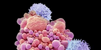 백혈병 치료 CAR-T세포 요법 12년간 재발 없어